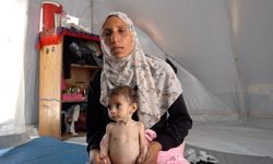 İsrail ablukası altındaki Gazze'de Zekeriyya bebek, yetersiz beslenmeyle mücadele ediyor