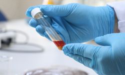 Tekirdağ'da üzüm atığından yüksek değerli tek hücre yağı üretildi