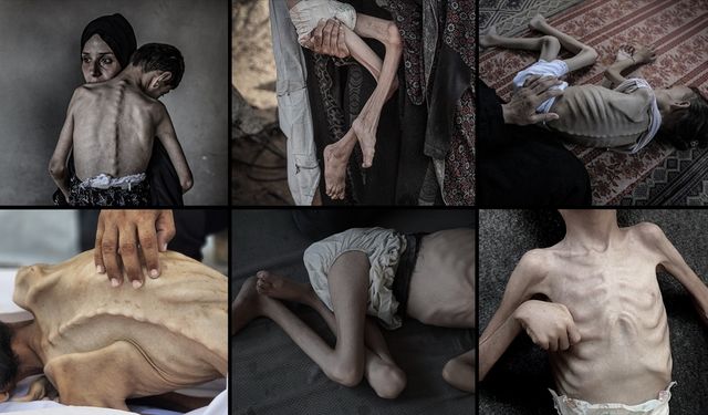İsrail, 2 yıldır sürdürdüğü soykırımda Filistinlileri sadece silahla değil 'açlıkla' da öldürüyor