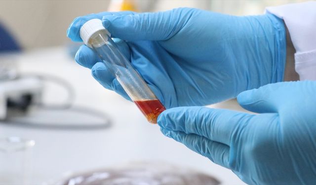 Tekirdağ'da üzüm atığından yüksek değerli tek hücre yağı üretildi