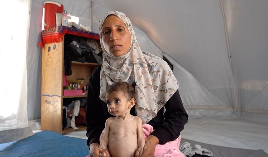 İsrail ablukası altındaki Gazze'de Zekeriyya bebek, yetersiz beslenmeyle mücadele ediyor