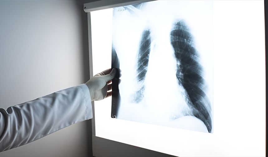 Sık yaşanan viral enfeksiyonlar akciğer kapasitesini düşürüyor